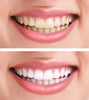 emmi®-dent Ultraäänihammasharja Metallic Musta, laturi ja Fresh tahna