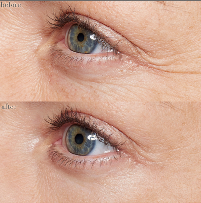 Instant Effects Silmänympärysseerumi häivyttää silmäpussit